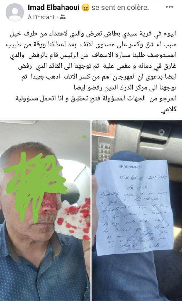 تدوينة إبن الصحية تحكي قمة الحگرة والظلم في سيدي بطاش 